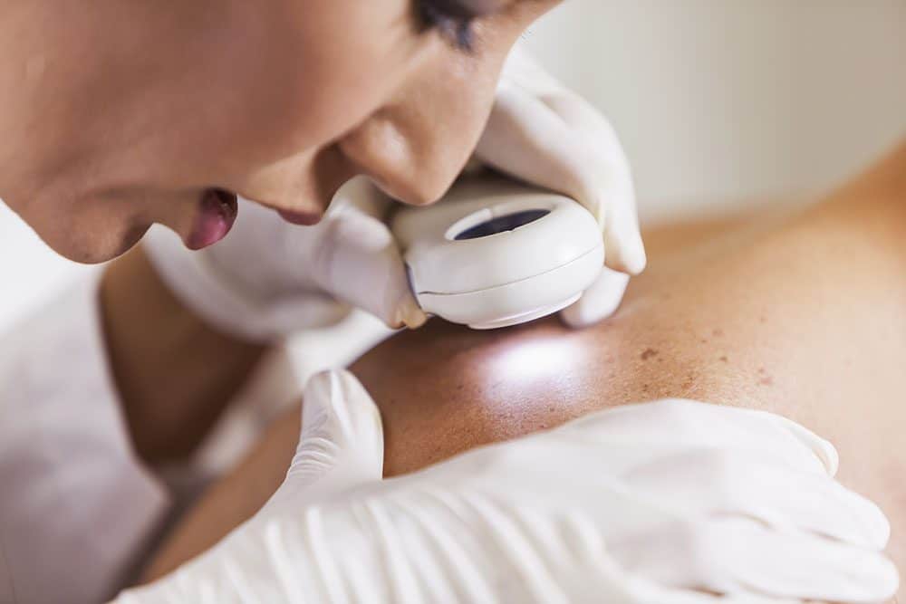 skin care Skin Cancer Treatment Sarasota FL