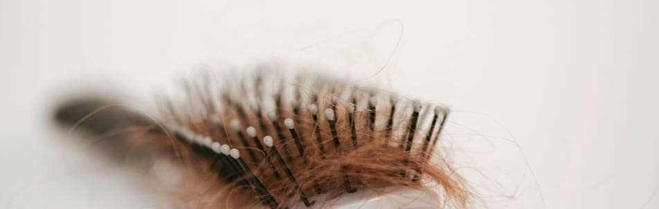 iStock 25 Hair Loss Treatment Sarasota FL