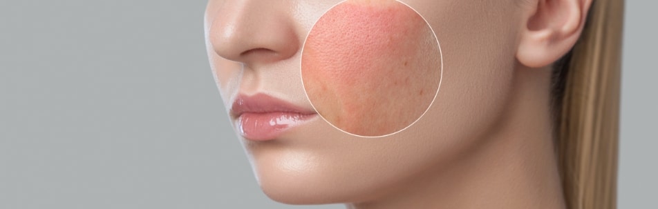 Medical Dermatology Sarasota FL