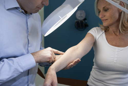 Dermatologist looking at womans mole with magnifier