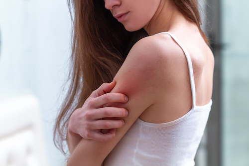 Young woman who suffers from psoriasis itching her skin