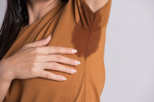 Close up,Asian,Woman,With,Hyperhidrosis,Sweating.,Young,Asia,Woman,With