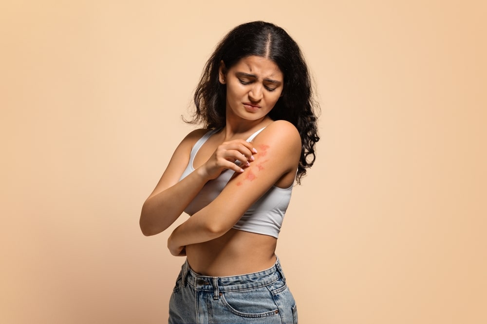 A woman with psoriasis scratching her shoulder