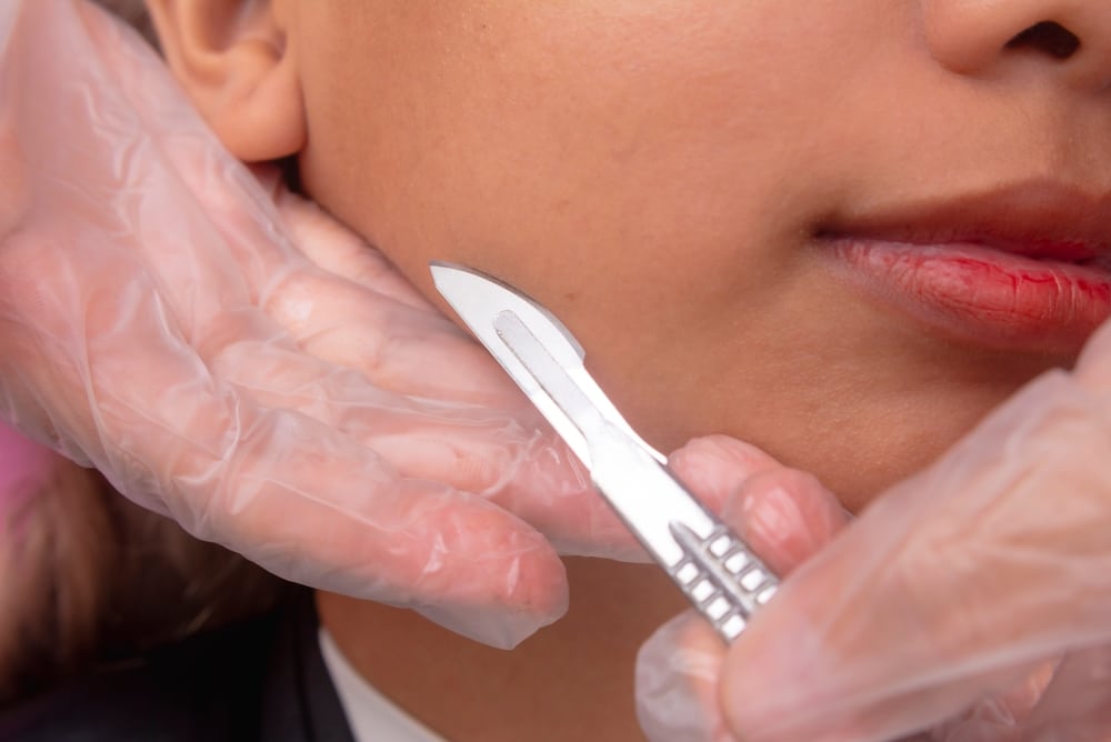 A close-up shows a dermaplaning procedure being performed to gently shave and exfoliate the skin, revealing a smoother, brighter complexion.