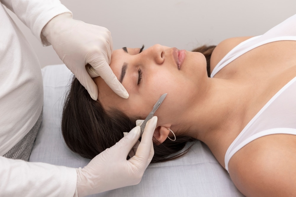 A young woman lies on a treatment table at a beauty center while a professional performs dermaplaning with a scalpel to exfoliate and smooth her facial skin.